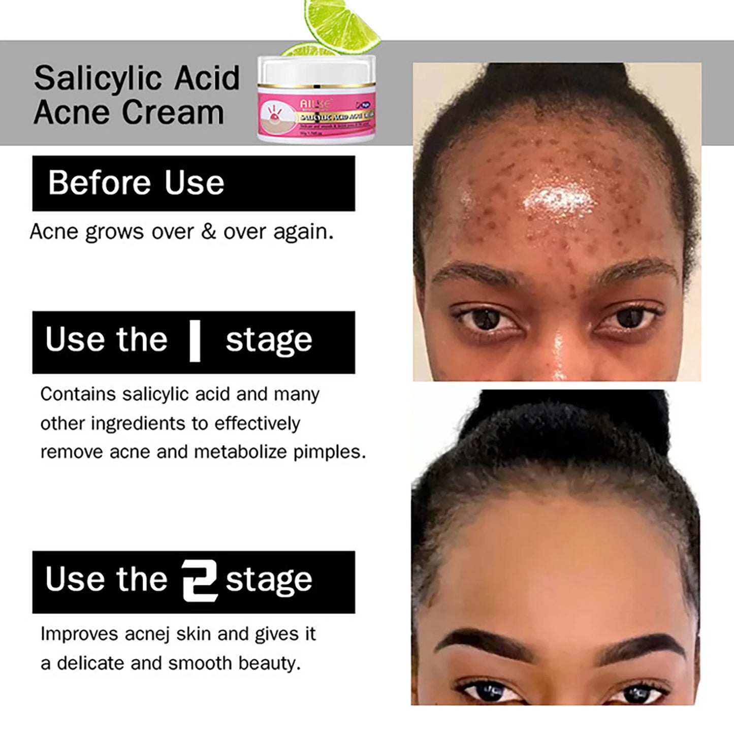 AILKE Skin Glowing Set for Women, Moisturizing, Brightening, Nourishing, Smooth, Anti Acne, Skin Radiant Kit With Niacinamide