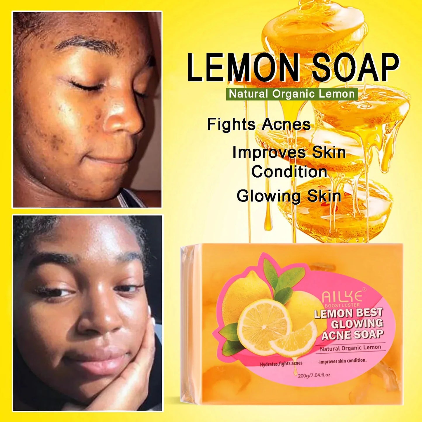 AILKE Skin Glowing Set for Women, Moisturizing, Brightening, Nourishing, Smooth, Anti Acne, Skin Radiant Kit With Niacinamide