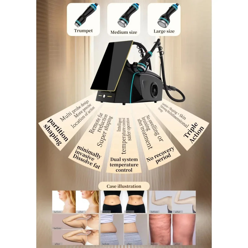 2026 NEW Onda Ice-Microwave 2.45GHz Skin Tightening Machine for Body Contouring and Anti-Cellulite Treatment Beauty Machine