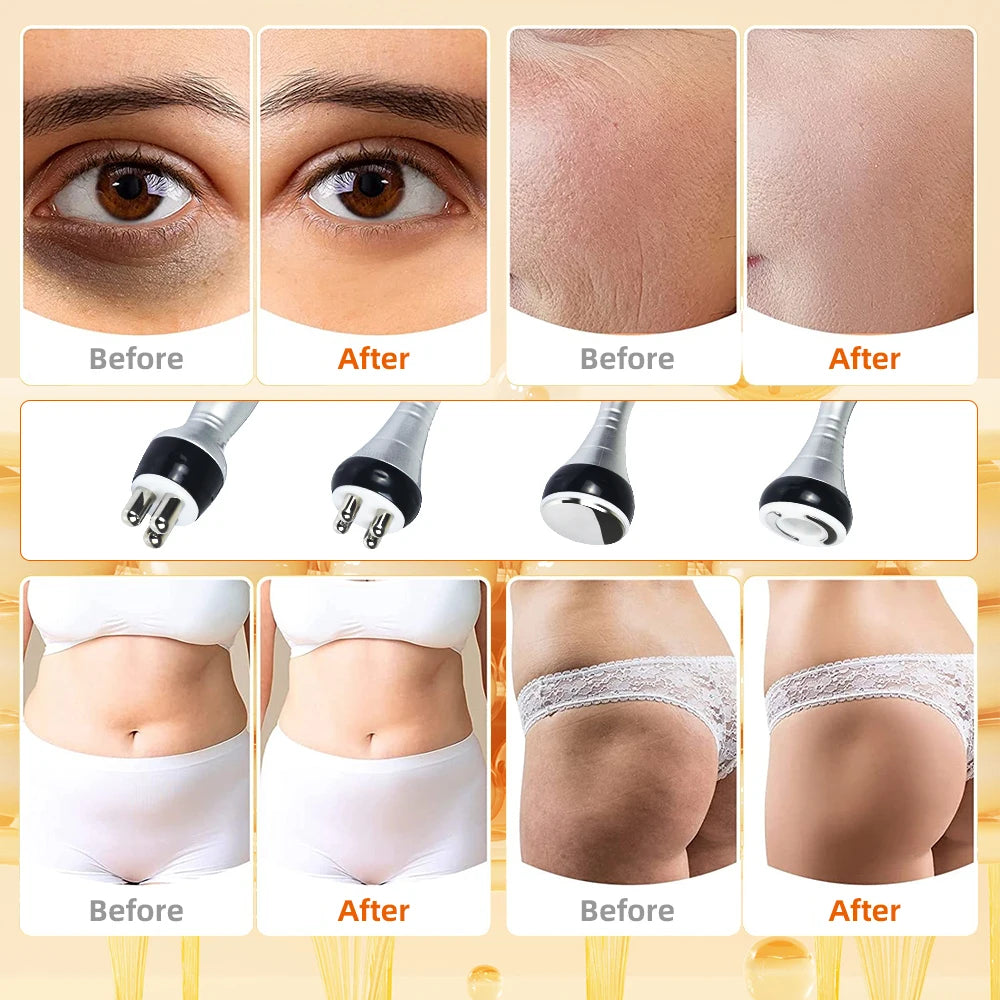 4 IN 1 40K Cavitation Ultrasonic Body Slimming Machine  Beauty Device Facial Massager Skin Tighten Face Lifting Vacuum Suction